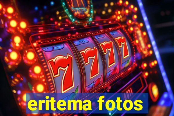 eritema fotos